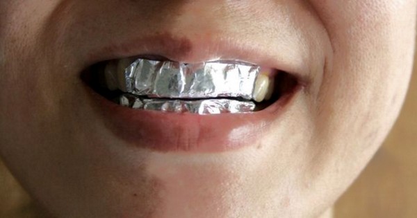 Вот что произойдёт с зубами, если вы обернёте их алюминиевой фольгой